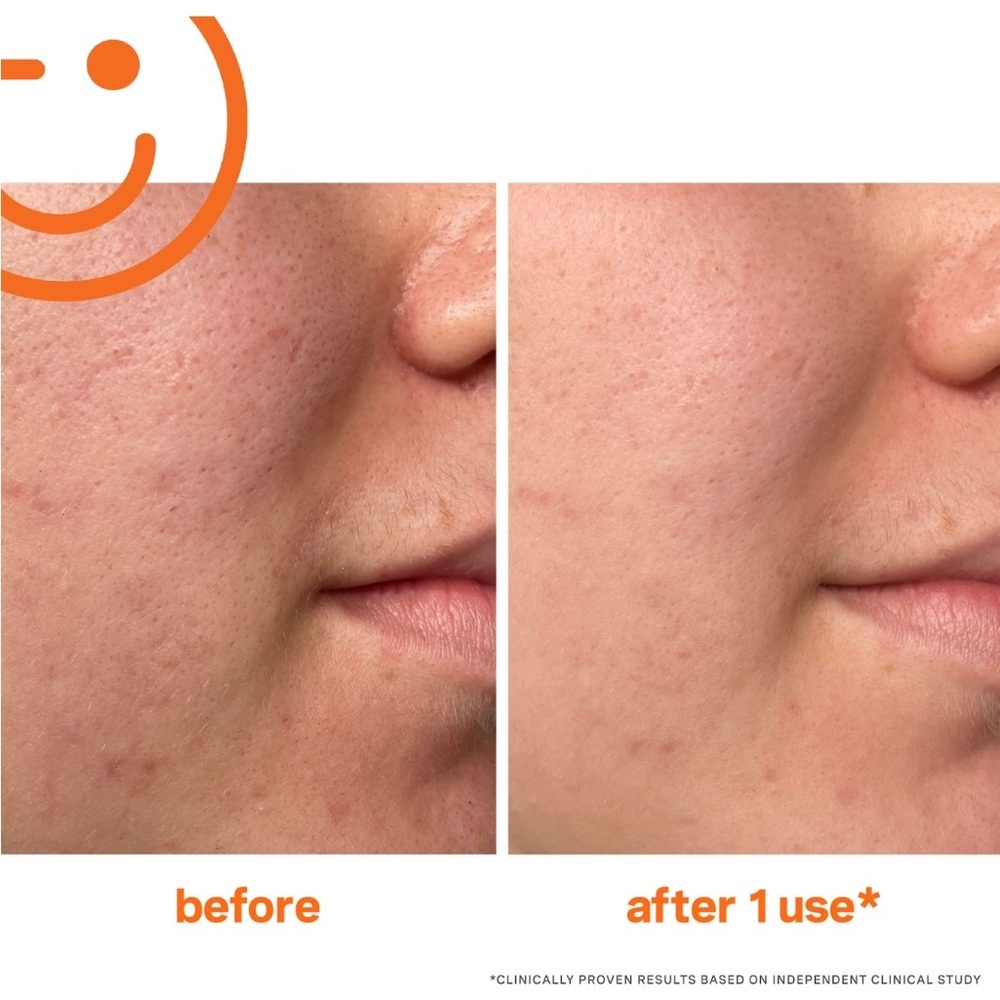 KATE SOMERVILLE • EXFOLIKATE INTENSIVE EXFOLIATING TREATMENT • BRAND NEW IN BOX - Picture 2 of 10